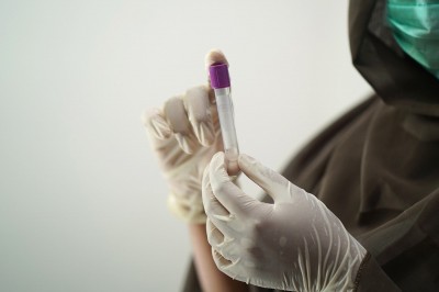 Beta Hcg
